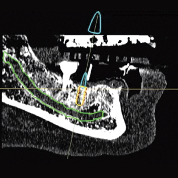 Advanced Non-Invasive Position Tracking System